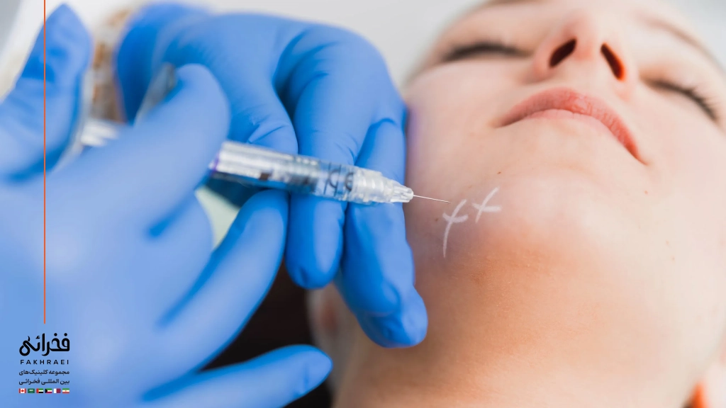 تزریق فیلر چانه چگونه انجام می‌شود؟