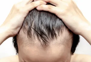 تلوژن افلوویوم