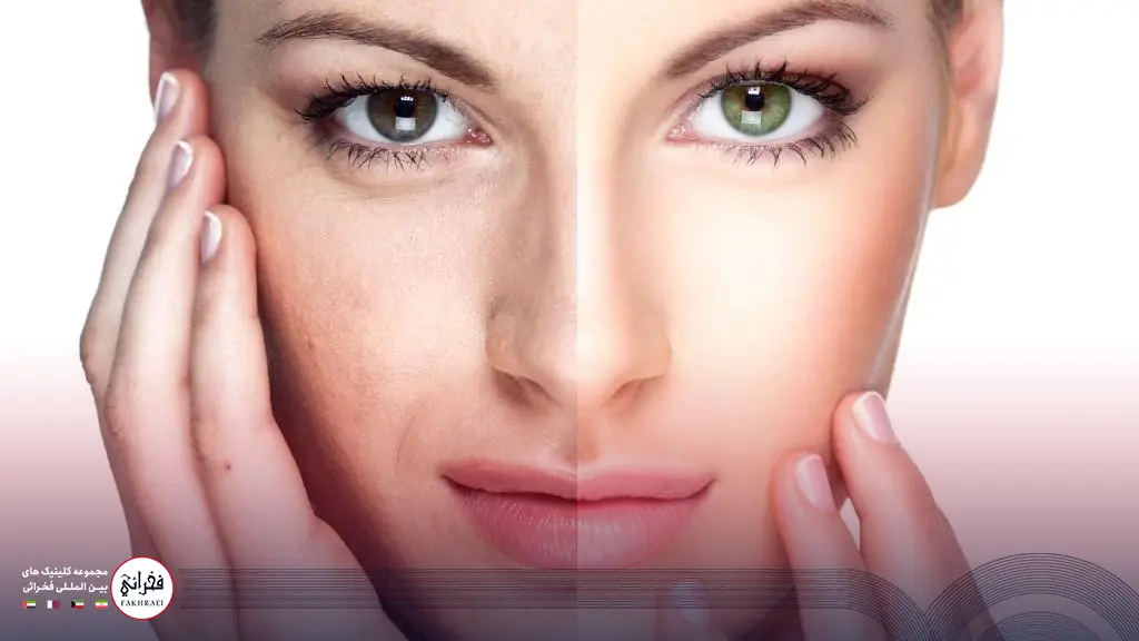 تصویر قبل و بعد از جوانسازی