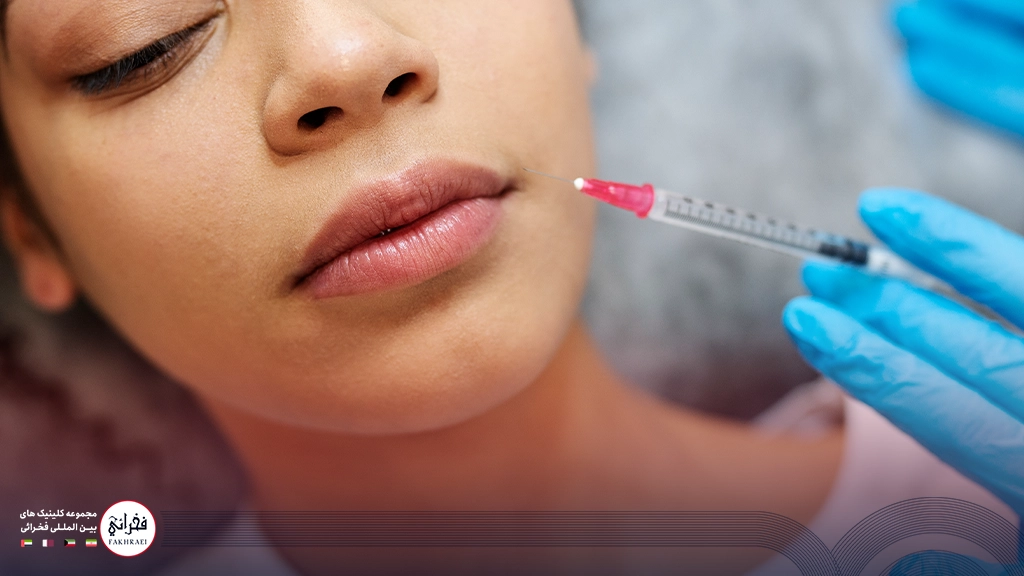 تزریق ژل لب نچرال-در حال تزریق ژل لب
