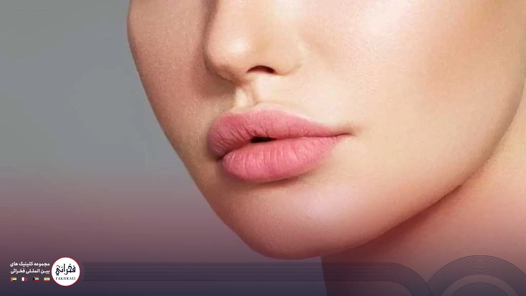 تزریق ژل لب عروسکی -لب های عروسکی خانمی