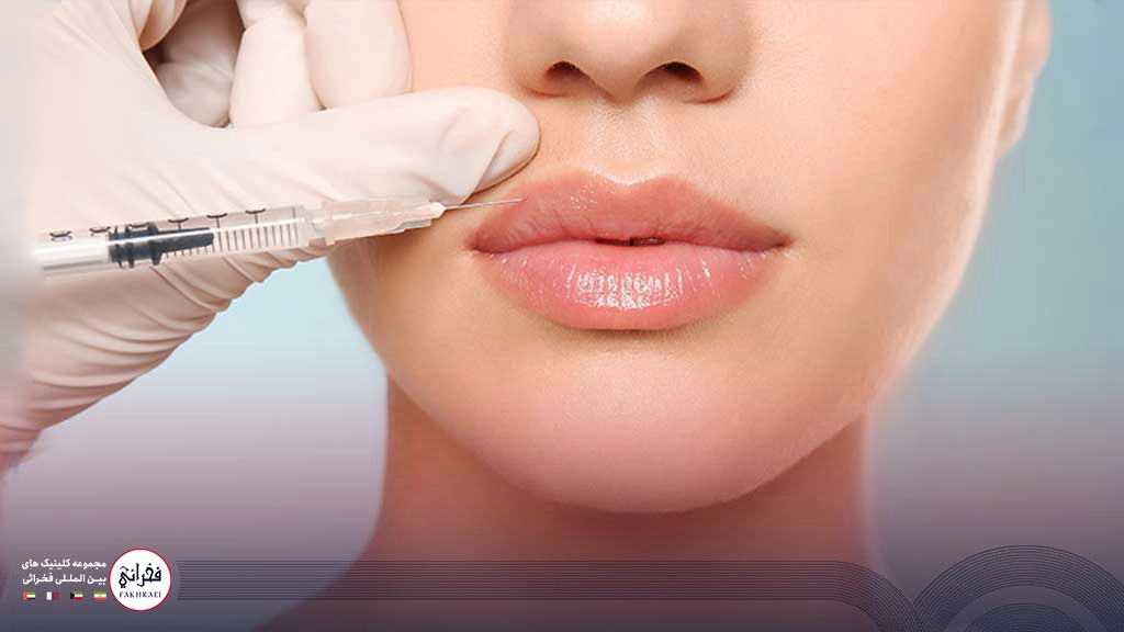 تزریق ژل لب مدل چاک دار -لب های خانمی