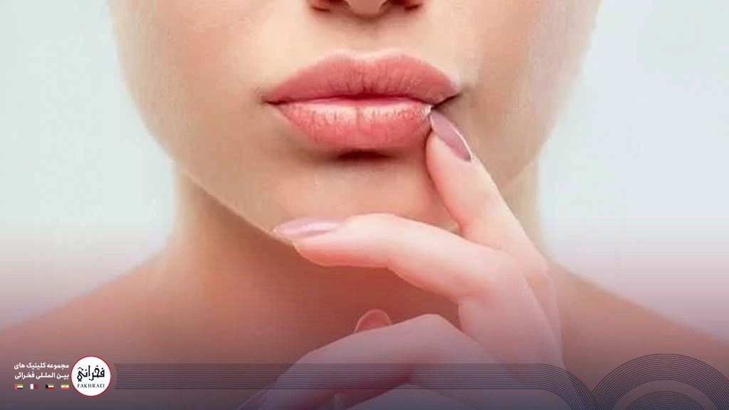 تزریق ژل لب قلبی -تصویر لب های زیبا