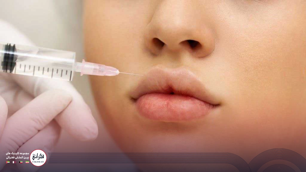 تزریق ژل لب قلبی -تزریق ژل لب