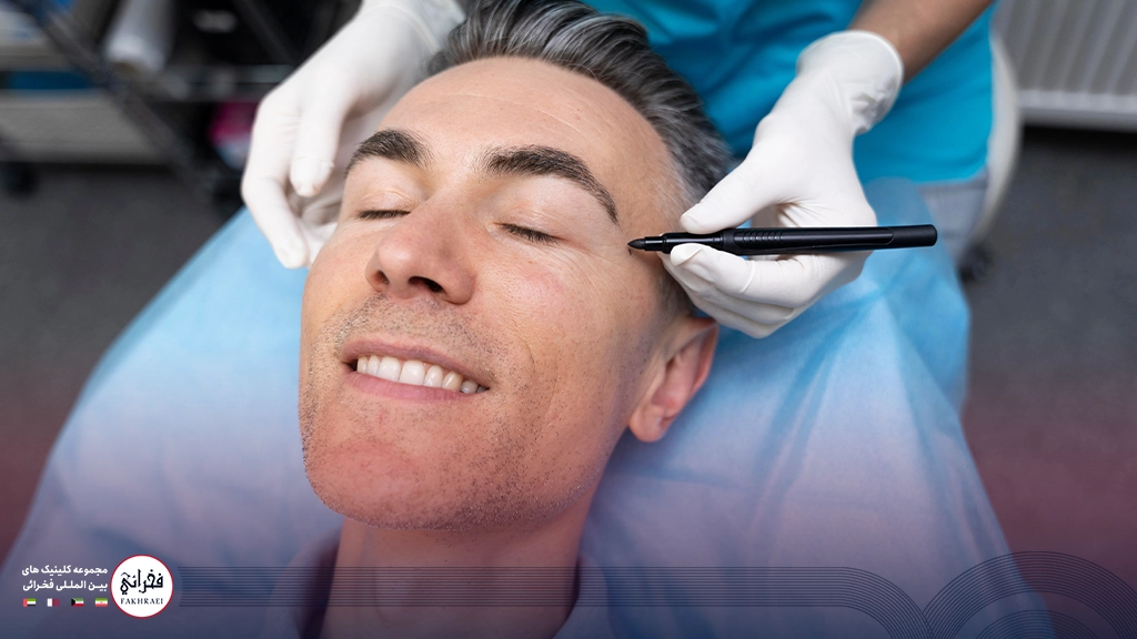 کاشت ابرو مردانه-مردی با ابرو پرپشت