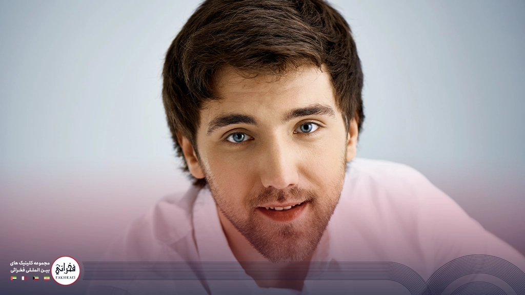 کاشت ابرو مردانه-مردی با ابرو پرپشت