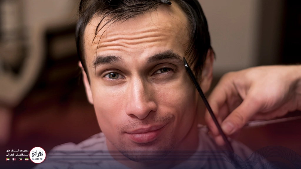 کاشت ابرو مردانه-مردی با ابرو پرپشت
