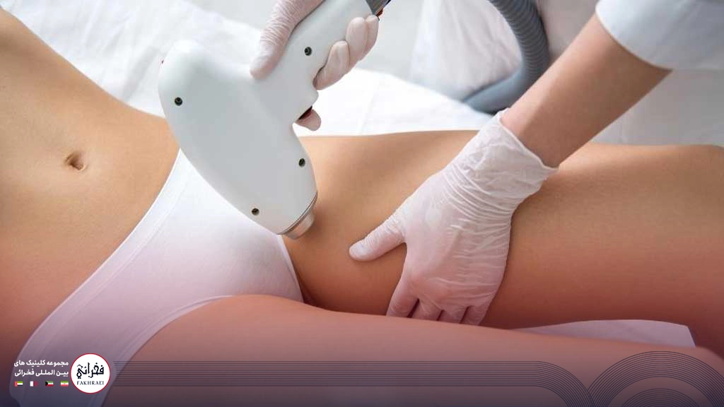 عکس لیزر موهای زائد ناحیه تناسلی زنان