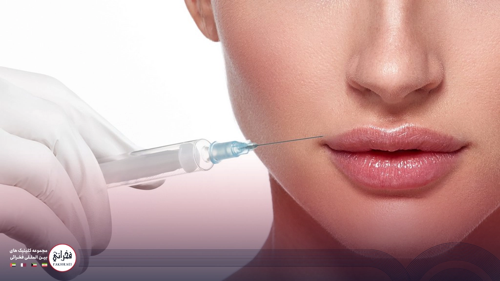 انجام فیلر لب مدل روسی برای یک خانم