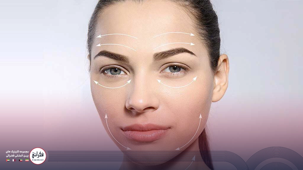 ژل پروفایلو -لیفت صورت