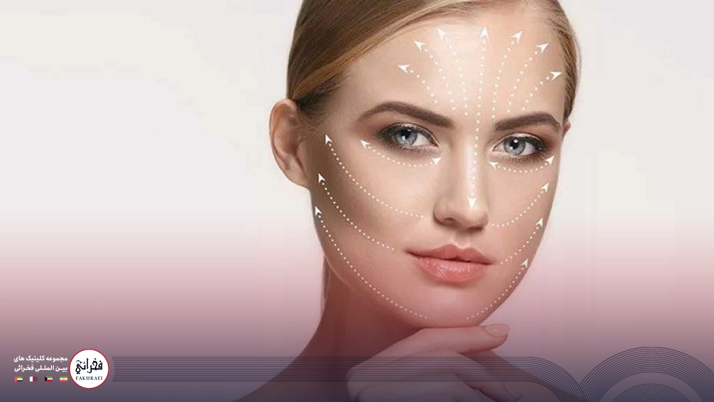 ژل پروفایلو -لیفت صورت