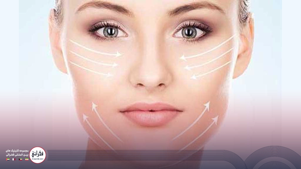 ژل پروفایلو -لیفت صورت