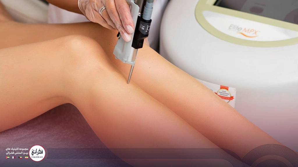 لیزر موهای زائد پا با دستگاه سایناشور