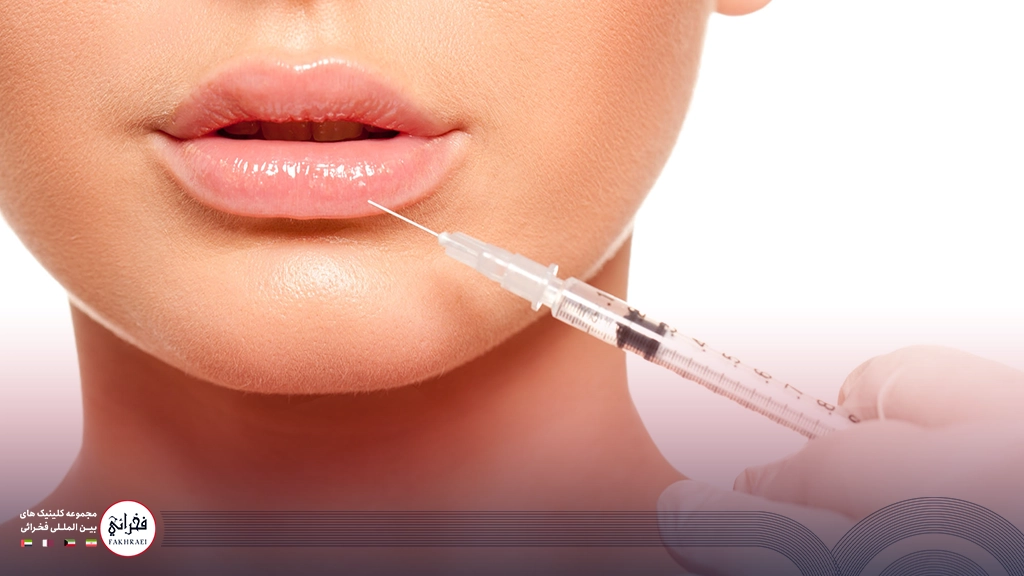 تزریق ژل لب مدل فانتزی -تزریق ژل به لب خانمی