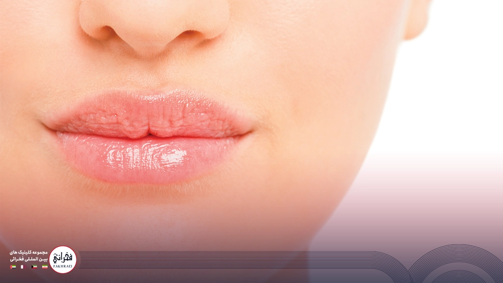 تزریق ژل لب مدل سه دکمه ای-لب های ژل زده خانومی