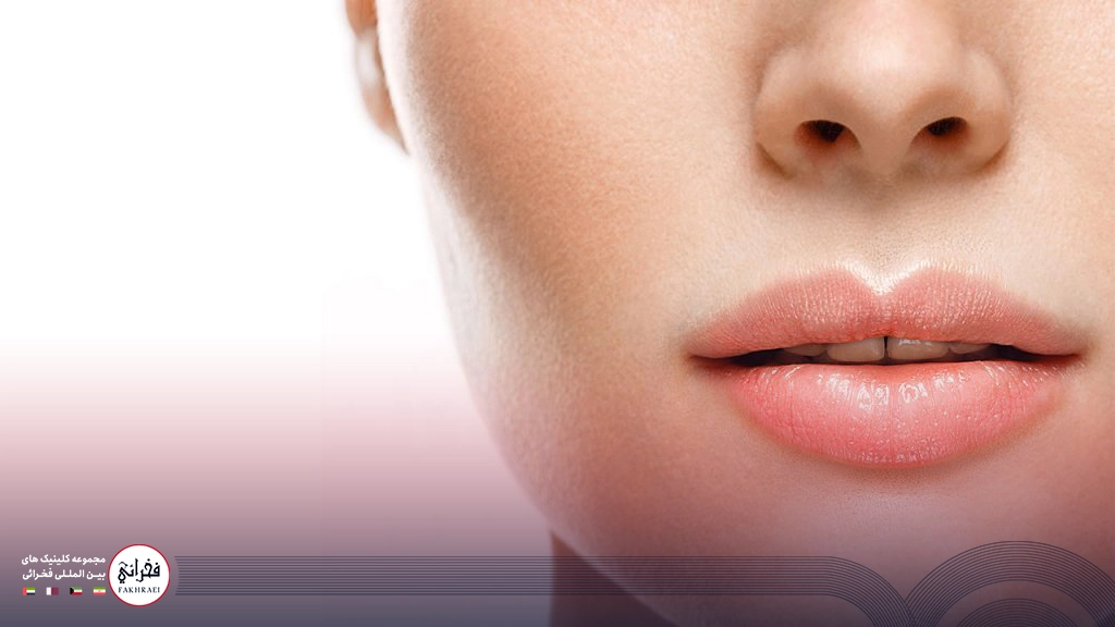 تزریق ژل لب مدل گرد-لب های زیبای خانومی