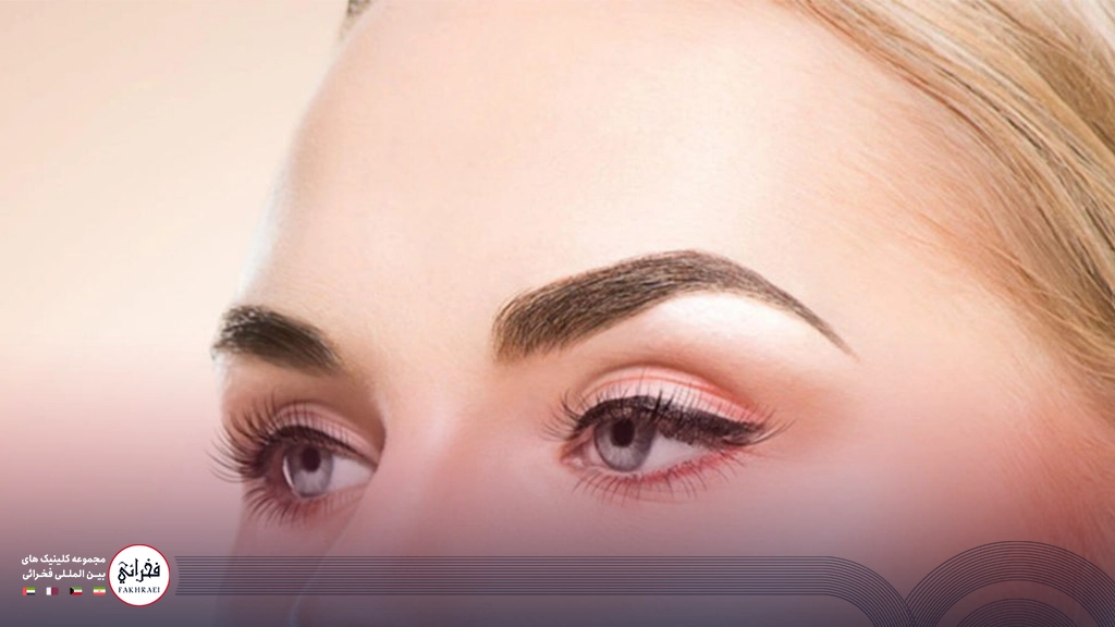 کاشت ابرو میکروگرافت-تصویر خانومی با ابرو پر