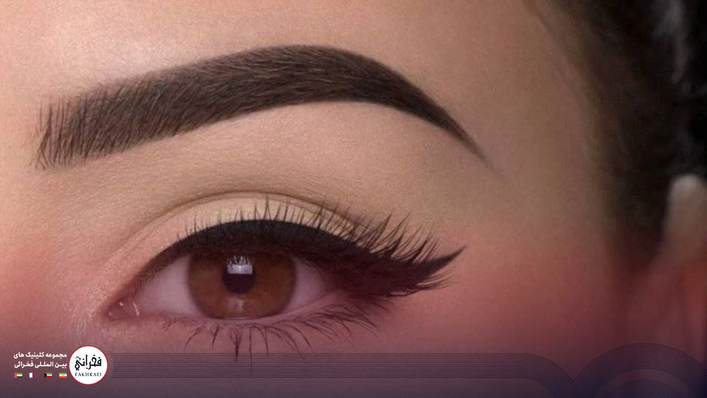 کاشت ابرو میکروگرافت-تصویر خانومی با ابرو پر