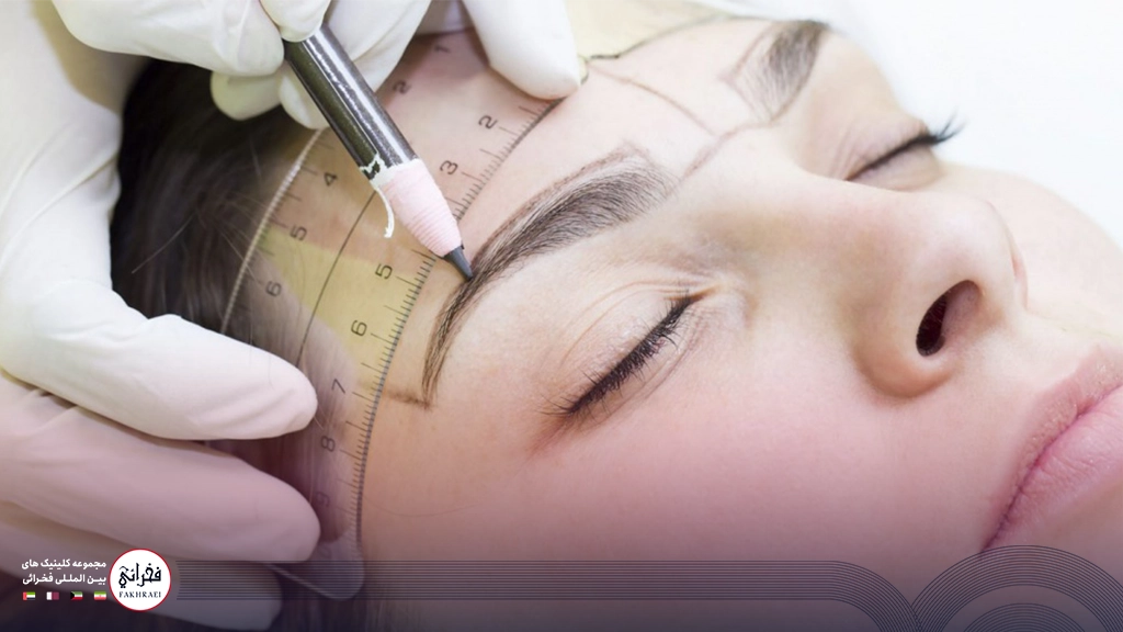 کاشت ابرو میکروگرافت-تصویر خانومی در حال کاشت ابرو