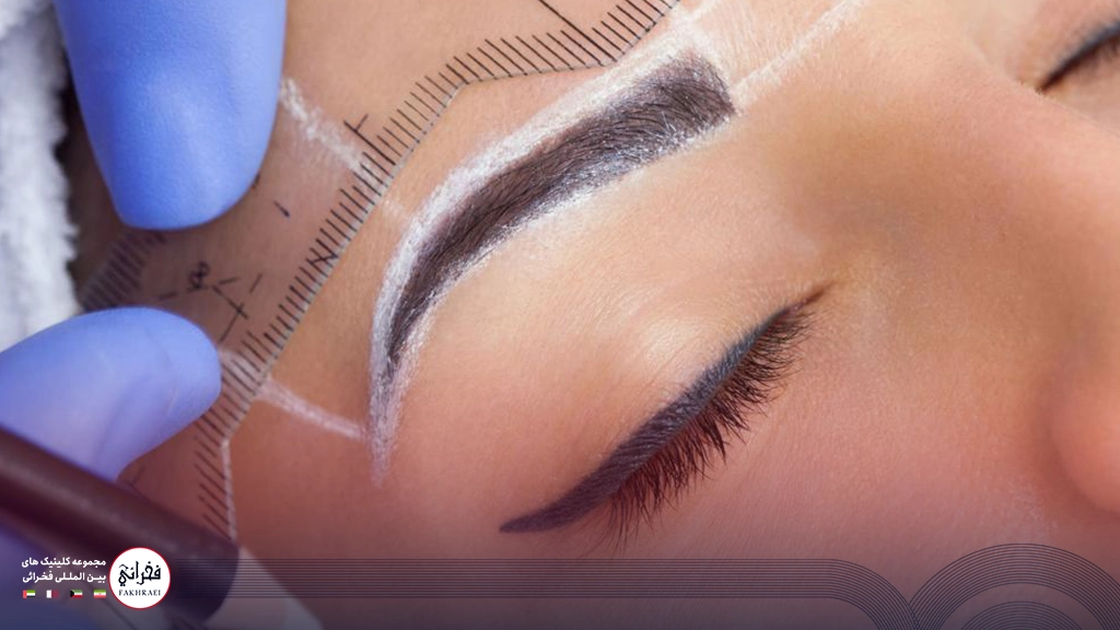 کاشت ابرو میکروگرافت-تصویر خانومی در حال کاشت ابرو