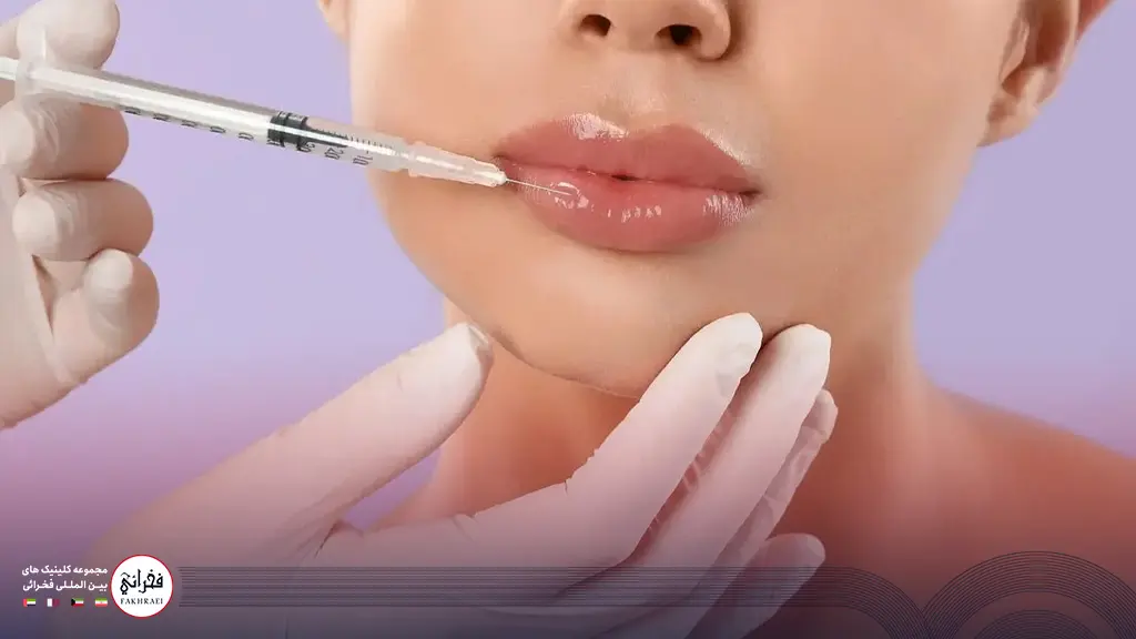 تزریق چند سی سی ژل لب مدل روسی