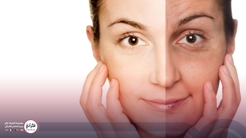 لیزر اربیوم یا CO2-نیمی از صورت سفید نیمی تیره