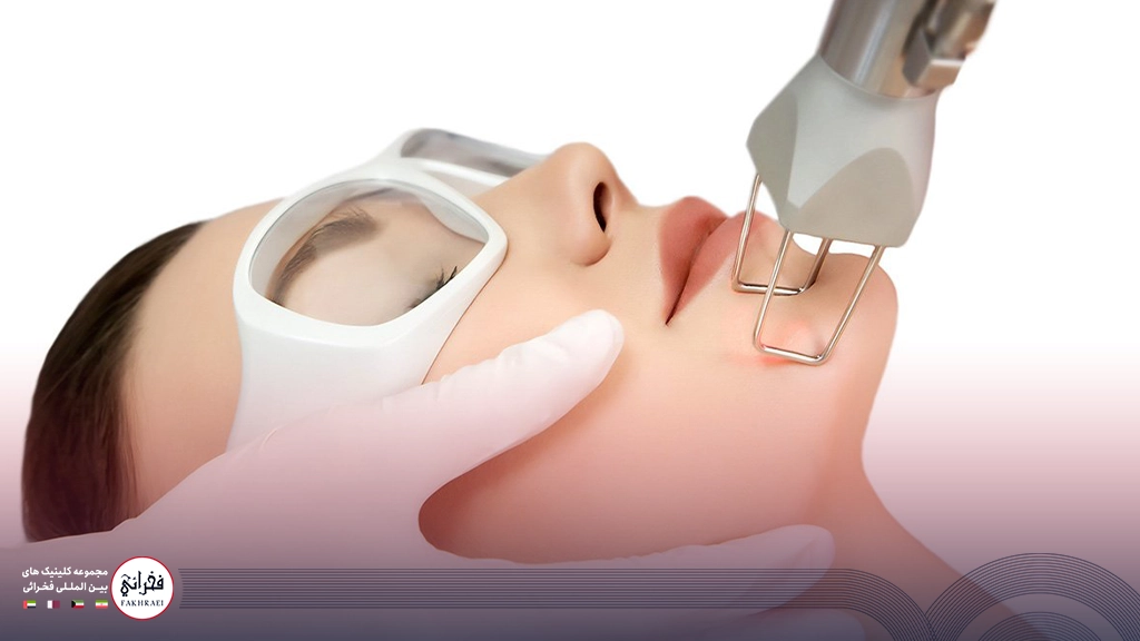 لیزر اربیوم یا CO2-در حال انجام لیزر صورت