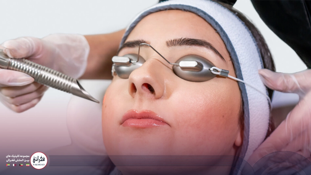 لیزر اربیوم یا CO2-خانمی با عینک لیزر در حال انجام لیزر صورت