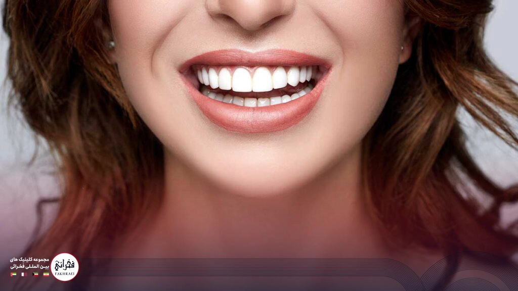 تزریق ژل لب مدل هالیوودی-نمایی از لب های برجسته هالیوودی خانومی