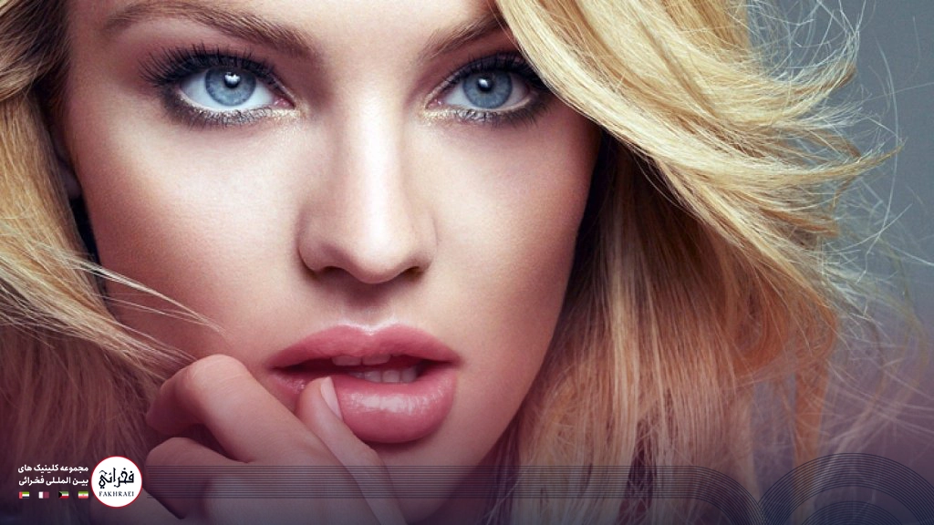 تزریق ژل لب مدل هالیوودی-نمایی از لب های برجسته هالیوودی خانومی