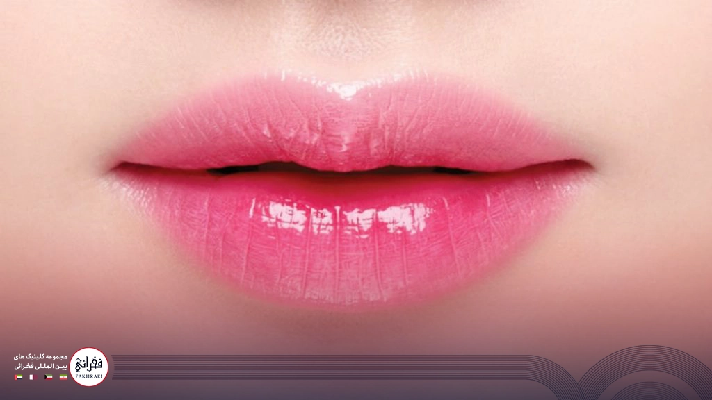 تزریق ژل لب مدل هالیوودی-نمایی از لب های برجسته هالیوودی خانومی
