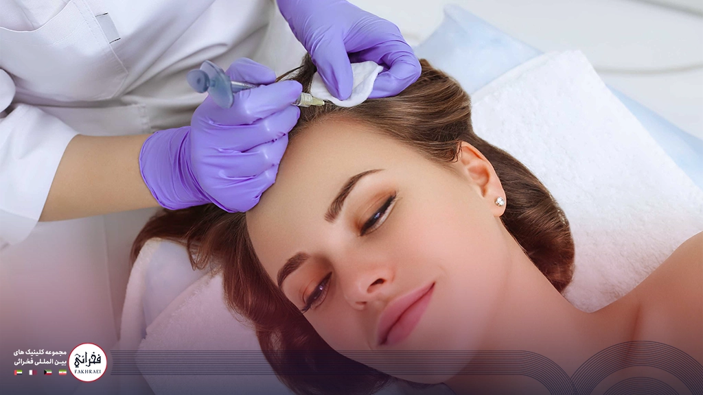 هیر فیلر-تزریق هیرفیلر به موی سر