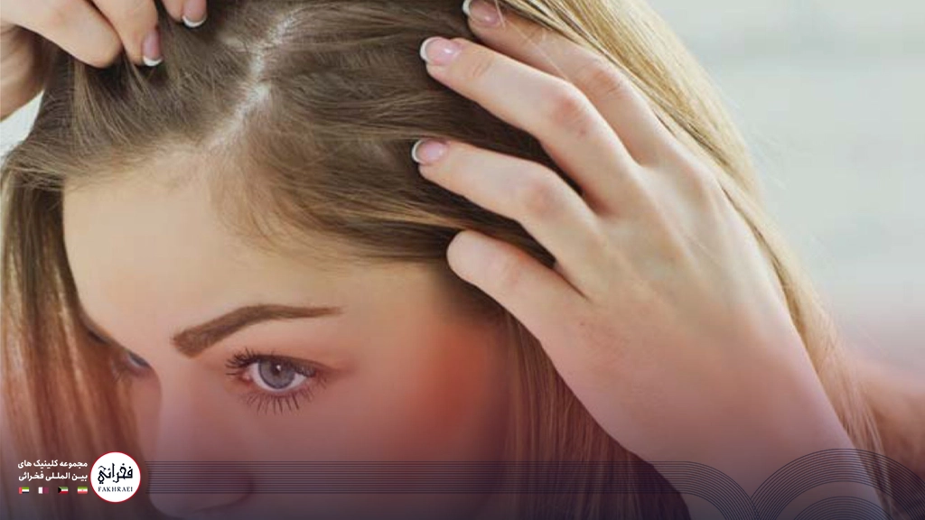 هیر فیلر-موی سر بور خانمی