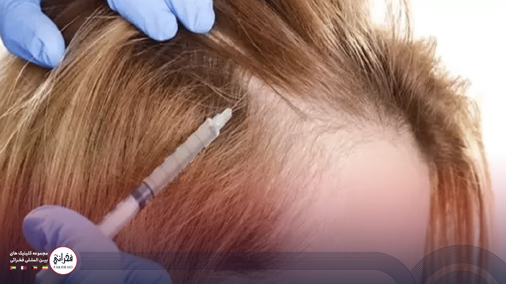 هیر فیلر-تزریق هیرفیلر
