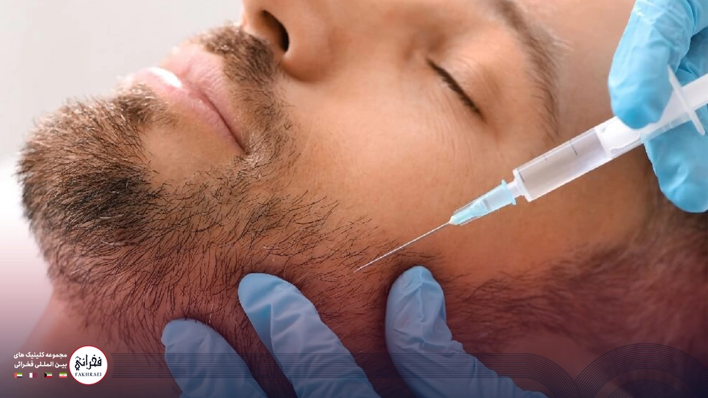 مزوتراپی ریش-مزوتراپی ریش روی صورت مردی