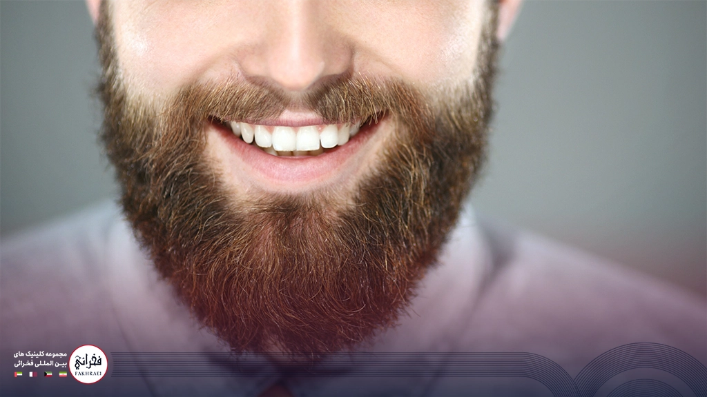 مزوتراپی ریش-صورت ریش دار مردی در حال خنده