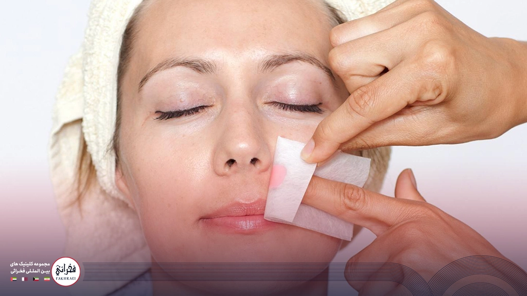 ازبینبردن موهای زائد صورت در خانه