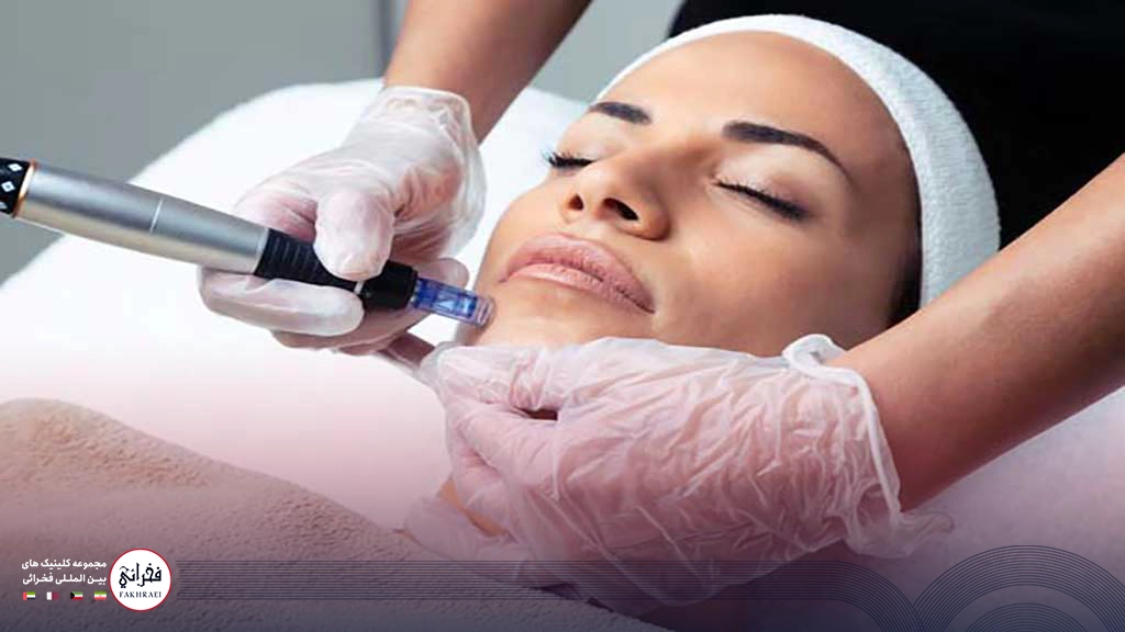 مزوتراپی ضد لک -در حال تزریق مزوژل به خانمی