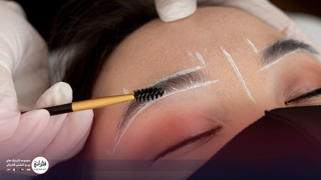 کاشت ابرو بدون جراحی -ابروی خانمی