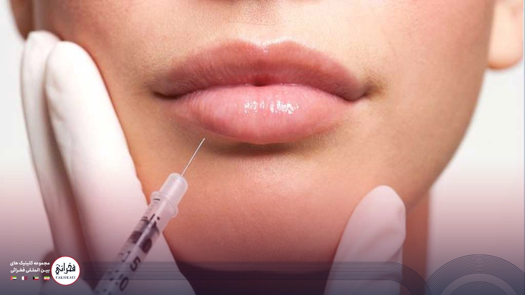 مقدار ژل موردنیاز بر تزریق به لب