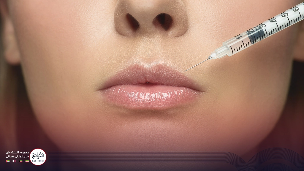 مراقبت‌های بعد از تزریق فیلر لب