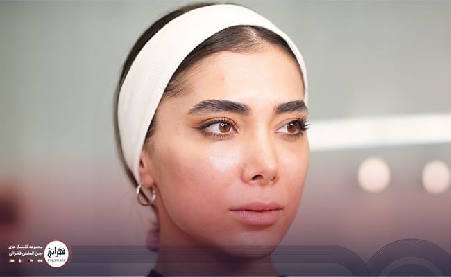 تزریق بوتاکس گونه