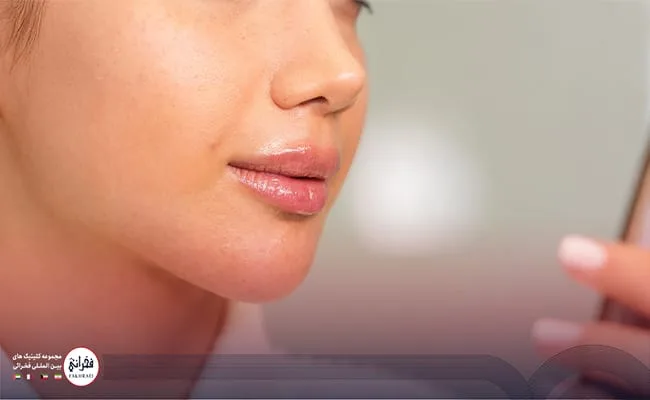تزریق ژل لب عروسکی، مزایا معایب و هزینه آن آشنا شوید