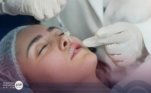 تزریق ژل لب مدل سه دکمه ای