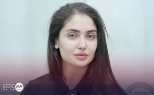 تزریق ژل لب نچرال