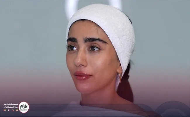 با تزریق ژل لب مدل صدفی از زیبایی خیره‌کننده خود لذت ببرید.