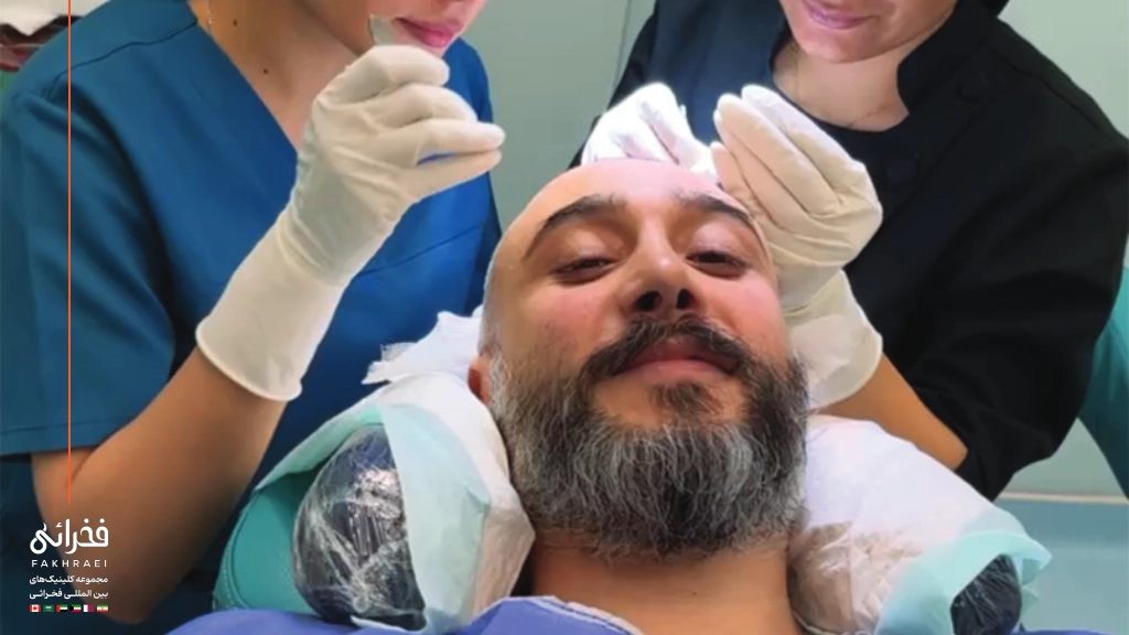 برای درد کاشت مو چه باید کرد