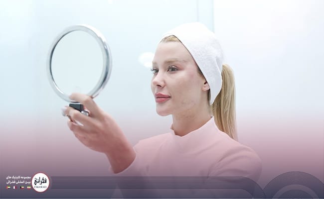 تزریق ژل لب مدل فانتزی