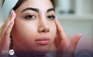 بوتاکس ابرو در کلینیک فخرائی