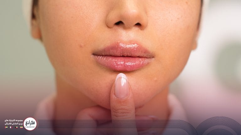 تزریق ژل لب مدل قلوهای؛ روشی محبوب برای ایجاد جلوهای خاص